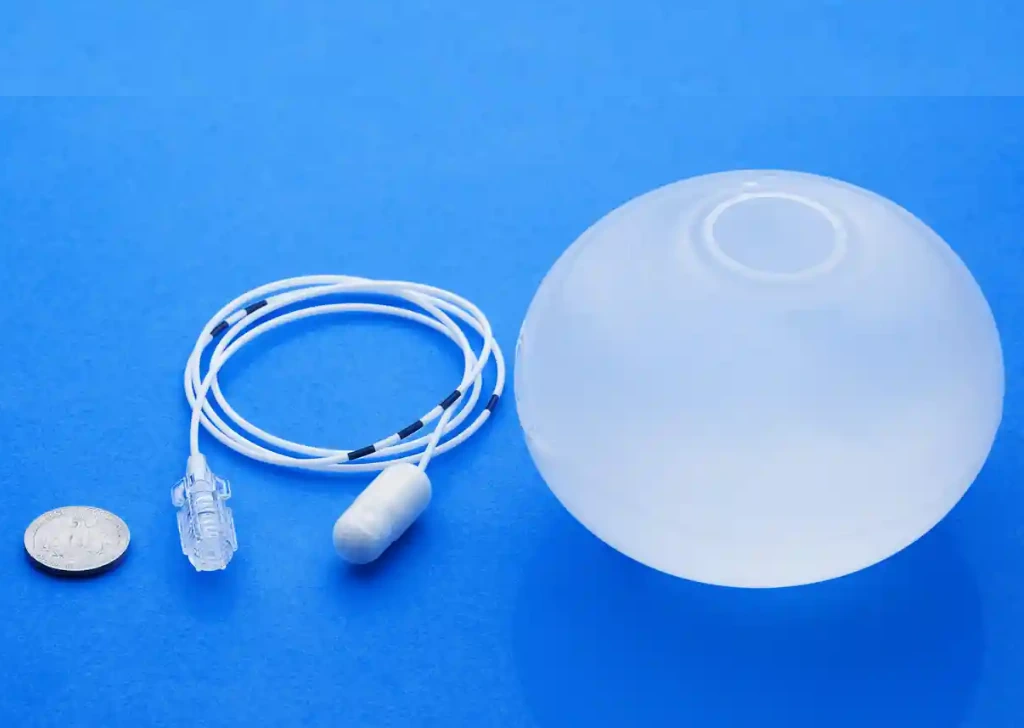 What is Gastric Balloon Treatment?